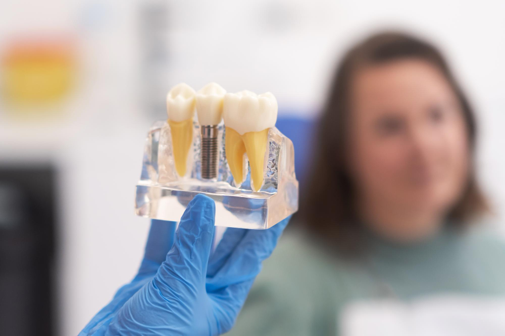 Close-up of a dental implant model showing artificial tooth and root structure