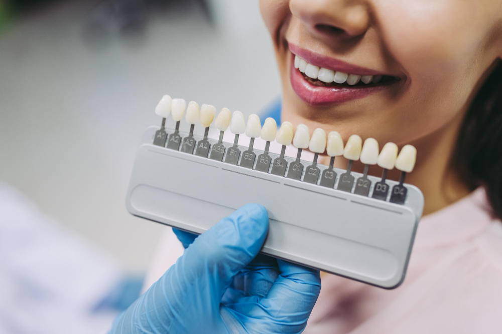 Dentist holding a tooth shade guide next to a patient’s smile for dental veneers